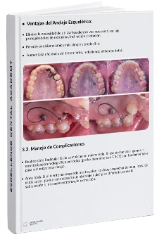Decisiones basadas en la previsión: mantener, retirar o extraer