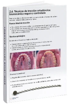 Resumen de los protocolos de prevención e interceptación